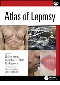 Atlas of Leprosy (Original PDF from Publisher + Videos)